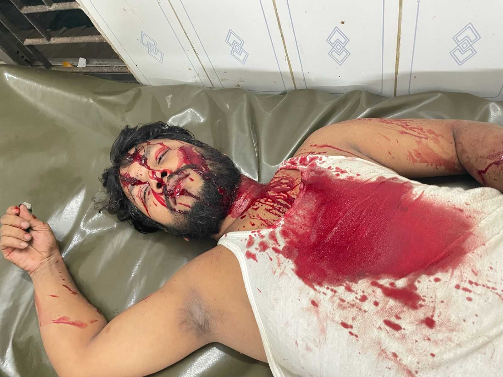 ব্রাহ্মণপাড়ায় প্রতিপক্ষের অতর্কিত হামলায় আহত-১, আটক- ২