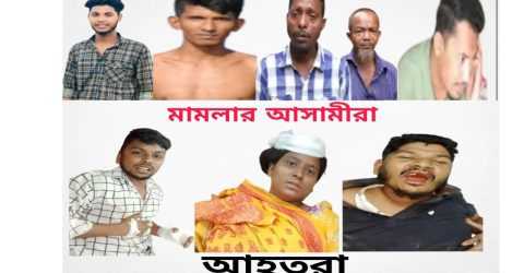 কুমিল্লায় মামলা প্রত্যাহার না করায় বাদী ও স্বাক্ষীদের মারধর কুমেক হসপিটালে ভর্তি ৪